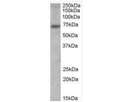 Anti-PAD4/PADI4 antibody produced in goataffinity isolated antibody, buffered aqueous solution