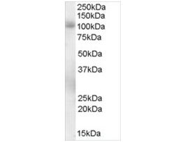 Anti-PDE5A antibody produced in goataffinity isolated antibody, buffered aqueous solution