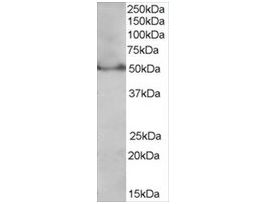 Anti-PPAR delta (Isoform 1) antibody produced in goataffinity isolated antibody, buffered aqueous solution