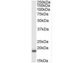 Anti-SOD1 antibody produced in goataffinity isolated antibody, buffered aqueous solution