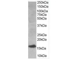 Anti-UBE2I antibody produced in goataffinity isolated antibody, buffered aqueous solution