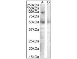 Anti-SULF2 antibody produced in goataffinity isolated antibody, buffered aqueous solution