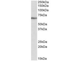 Anti-IGF2BP1 antibody produced in goataffinity isolated antibody, buffered aqueous solution