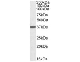 Anti-ARG1 (C-terminal) antibody produced in goataffinity isolated antibody, buffered aqueous solution