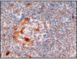 Anti-ZCCHC11 (C-terminal) antibody produced in goataffinity isolated antibody, buffered aqueous solution