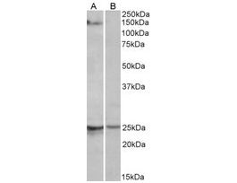 Anti-RBM20 antibody produced in goataffinity isolated antibody, buffered aqueous solution