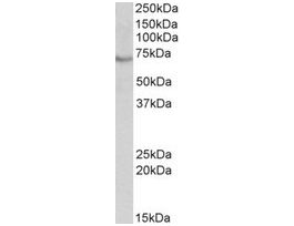 Anti-BIRC3 antibody produced in goataffinity isolated antibody, buffered aqueous solution