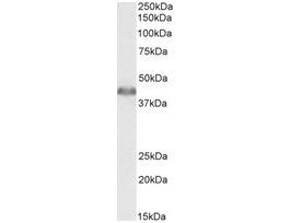 Anti-ACAT1 antibody produced in goataffinity isolated antibody, buffered aqueous solution