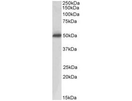 Anti-ACPP antibody produced in goataffinity isolated antibody, buffered aqueous solution