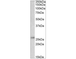 Anti-UCHL1 (C-terminal) antibody produced in goataffinity isolated antibody, buffered aqueous solution
