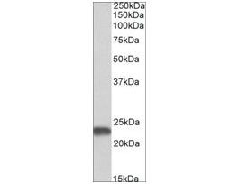 Anti-SOD2 antibody produced in goataffinity isolated antibody, buffered aqueous solution