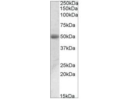 Anti-ACPP antibody produced in goataffinity isolated antibody, buffered aqueous solution