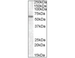 Anti-TFE3 (N-terminal) antibody produced in goataffinity isolated antibody, buffered aqueous solution