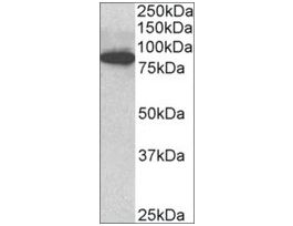 Anti-ODF2 antibody produced in goataffinity isolated antibody, buffered aqueous solution