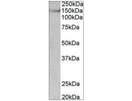 Anti-SYNGAP1 antibody produced in goataffinity isolated antibody, buffered aqueous solution