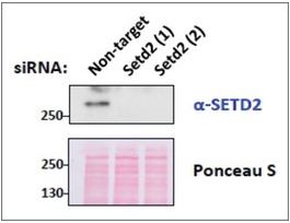 Anti-SETD2 antibody produced in goataffinity isolated antibody, buffered aqueous solution