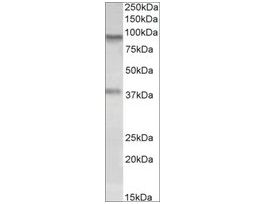 Anti-AOC3 antibody produced in goataffinity isolated antibody, buffered aqueous solution
