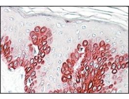 Anti-SIRT1 antibody produced in goataffinity isolated antibody, buffered aqueous solution