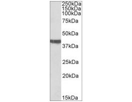 Anti-TNNT2 (C-terminal) antibody produced in goataffinity isolated antibody, buffered aqueous solution