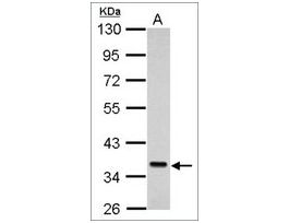 Anti-SEC61A1 antibody produced in rabbitaffinity isolated antibody, buffered aqueous solution