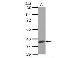 Anti-SLC25A1 antibody produced in rabbitaffinity isolated antibody, buffered aqueous solution
