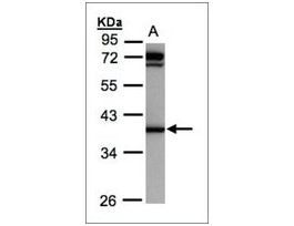 Anti-AKR1C1 antibody produced in rabbitaffinity isolated antibody, buffered aqueous solution