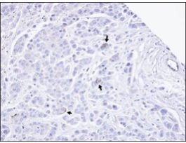 Anti-TRPM2 (N-terminal) antibody produced in rabbitaffinity isolated antibody, buffered aqueous solution