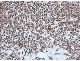 Anti-TOX antibody produced in rabbitaffinity isolated antibody, buffered aqueous solution