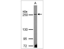 Anti-MAP1B antibody produced in rabbitaffinity isolated antibody, buffered aqueous solution