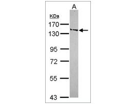 Anti-SMC6 antibody produced in rabbitaffinity isolated antibody, buffered aqueous solution