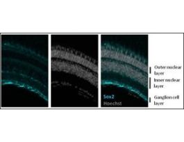 Anti-sox2 antibody produced in rabbitaffinity isolated antibody, buffered aqueous solution