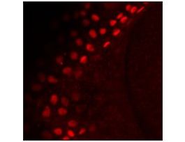 Anti-tp63 antibody produced in rabbitaffinity isolated antibody, buffered aqueous solution