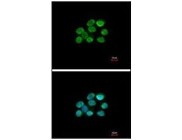 Anti-TRIM28 antibody produced in rabbit