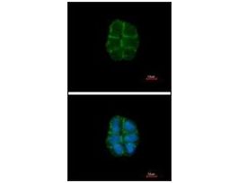 Anti-DSG2 (N-terminal) antibody produced in rabbit
