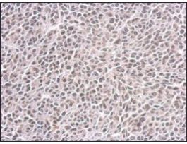 Monoclonal Anti-CENPF antibody produced in mouse