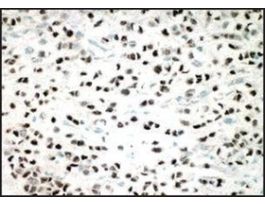 Monoclonal Anti-ESR2 antibody produced in mouse