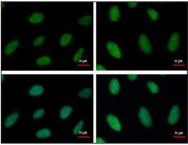 Monoclonal Anti-RPA2 antibody produced in mouse