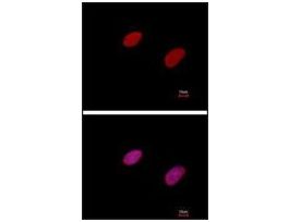 Monoclonal Anti-RBBP8 antibody produced in mouse