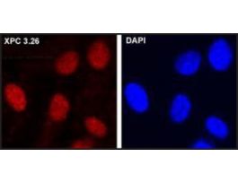 Monoclonal Anti-XPC antibody produced in mouse