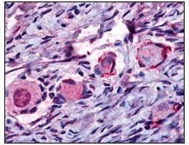 Anti-NR4A1 (AB1) antibody produced in rabbitaffinity isolated antibody, buffered aqueous solution