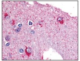 Anti-PYGB (AB2) antibody produced in rabbitaffinity isolated antibody, buffered aqueous solution