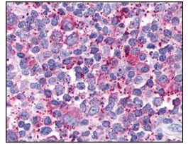 Anti-CX3CR1 antibody produced in rabbitaffinity isolated antibody, buffered aqueous solution