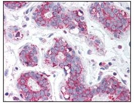 Anti-TBC1D1 antibody produced in rabbitaffinity isolated antibody, buffered aqueous solution