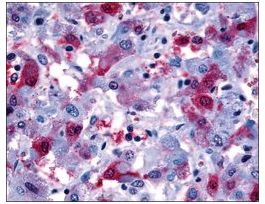 Anti-PTGFR antibody produced in rabbitaffinity isolated antibody