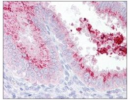 Anti-KIAA1324 antibody produced in rabbitaffinity isolated antibody