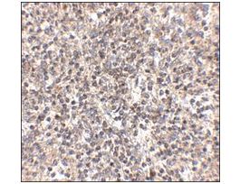 Anti-RSPO1 antibody produced in rabbitaffinity isolated antibody, buffered aqueous solution