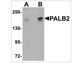 Anti-PALB2 antibody produced in rabbitaffinity isolated antibody, buffered aqueous solution