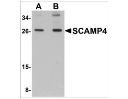 Anti-SCAMP4 antibody produced in rabbitaffinity isolated antibody, buffered aqueous solution