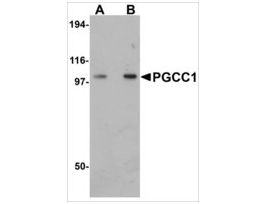 Anti-PGCC1 antibody produced in rabbitaffinity isolated antibody, buffered aqueous solution