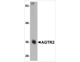 Anti-AGTR2 antibody produced in rabbitaffinity isolated antibody, buffered aqueous solution